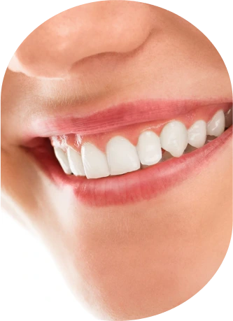 Invisalign/Clear Aligners